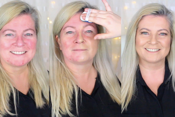 What's the Best Foundation for Covering Rosacea?